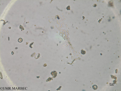 phyto/Brazilian_Nordeste/FernandodeNoronha_station42/ABRACOS2 April 2017/Helicotheca tamesis (diatomee8_cf_heliotheca_sp 170825_001_ovl -3)(copy)_thumb.jpg